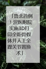 鲁北首例！滨医附院实施3D打印全距骨假体并人工全踝关节置换术